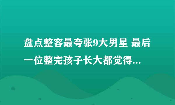 盘点整容最夸张9大男星 最后一位整完孩子长大都觉得是捡来的