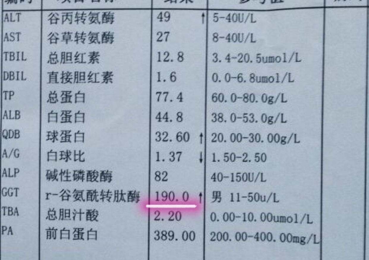 医学上GGT是指什么