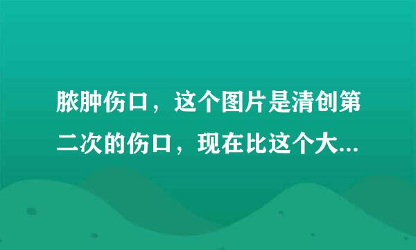 脓肿伤口，这个图片是清创第二次的伤口，现在比这个大一部分。请问是