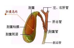 胆囊息肉最佳治疗方法是什么？