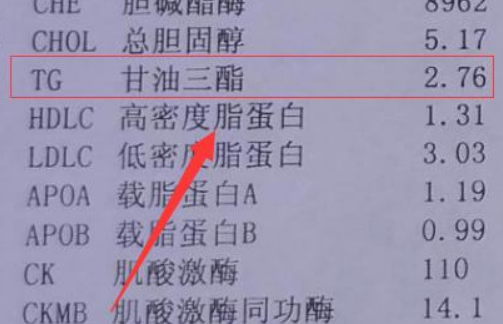 甘油三酯高多少算严重