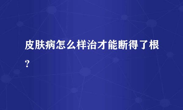 皮肤病怎么样治才能断得了根？