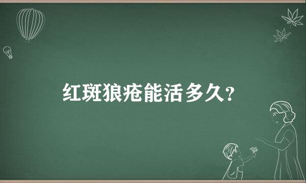 红斑狼疮能活多久？