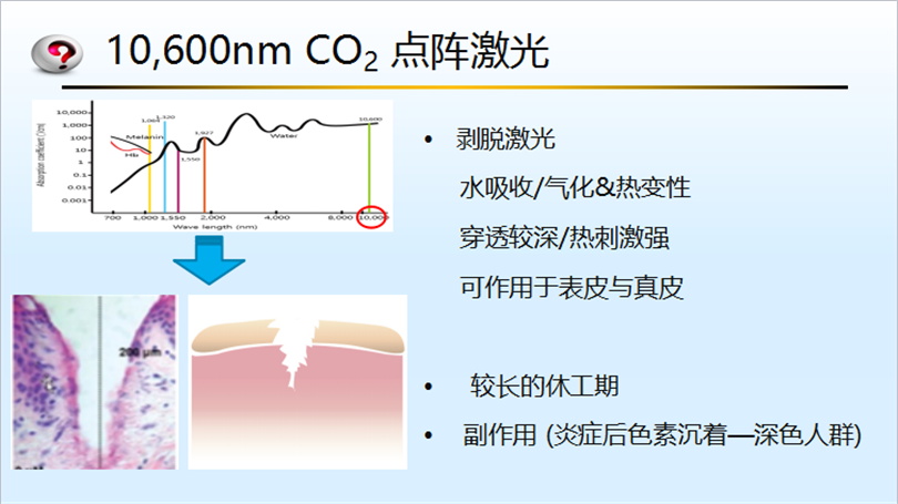 像素激光和点阵激光的区别是什么