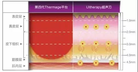 面部的提升的最佳方法