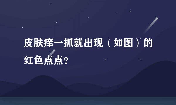 皮肤痒一抓就出现（如图）的红色点点？