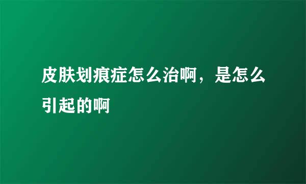 皮肤划痕症怎么治啊，是怎么引起的啊