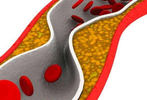 “低密度脂蛋白胆固醇”指标低于正常范围有什么不良后果吗？
