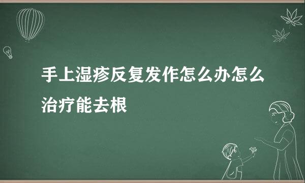 手上湿疹反复发作怎么办怎么治疗能去根