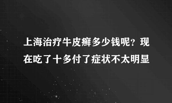 上海治疗牛皮癣多少钱呢？现在吃了十多付了症状不太明显