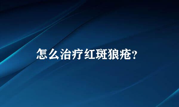 怎么治疗红斑狼疮？