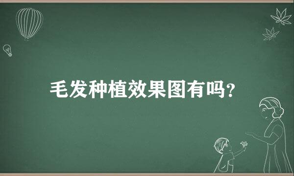 毛发种植效果图有吗？