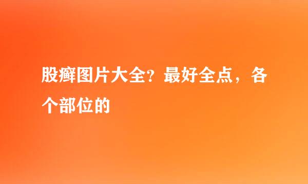 股癣图片大全？最好全点，各个部位的