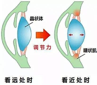 怎样才能彻底治疗好近视眼