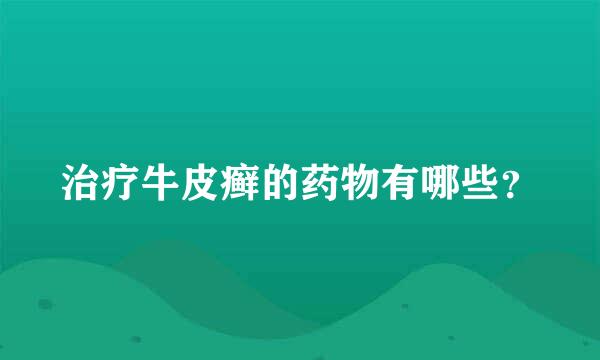 治疗牛皮癣的药物有哪些？