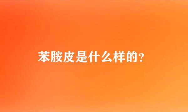 苯胺皮是什么样的？