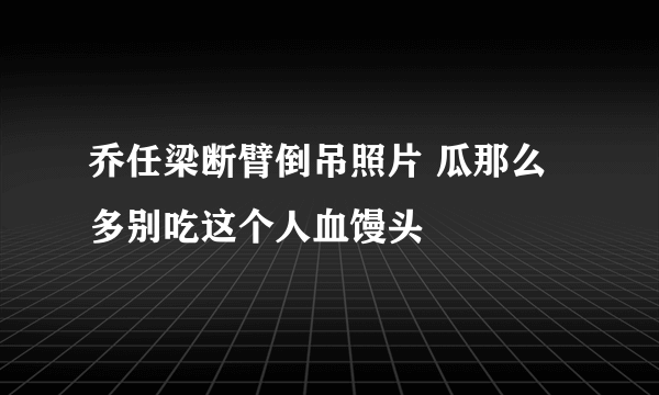 乔任梁断臂倒吊照片 瓜那么多别吃这个人血馒头