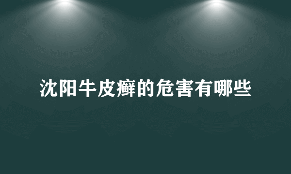 沈阳牛皮癣的危害有哪些