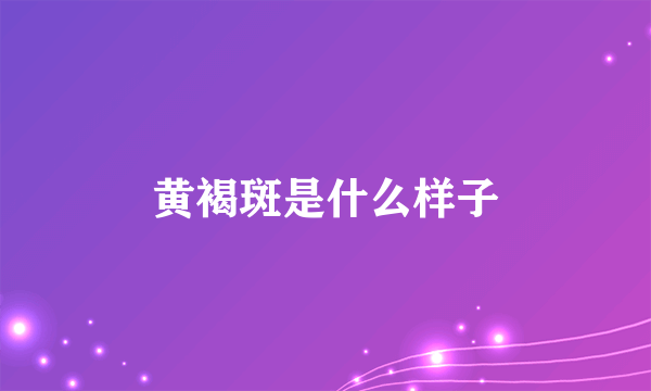 黄褐斑是什么样子