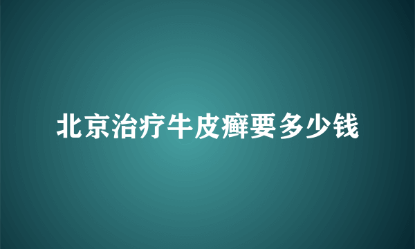 北京治疗牛皮癣要多少钱