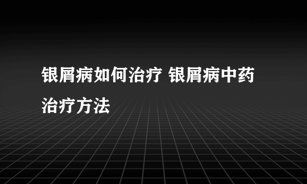 银屑病如何治疗 银屑病中药治疗方法