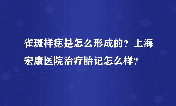 雀斑样痣是怎么形成的？上海宏康医院治疗胎记怎么样？