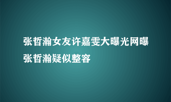 张哲瀚女友许嘉雯大曝光网曝张哲瀚疑似整容