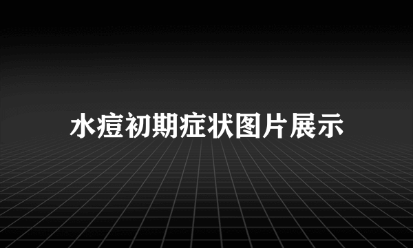 水痘初期症状图片展示