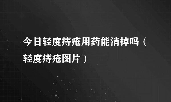 今日轻度痔疮用药能消掉吗（轻度痔疮图片）