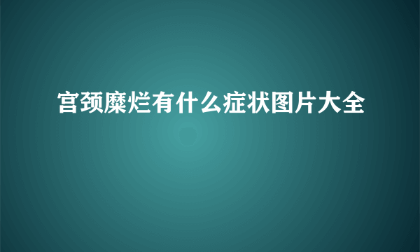 宫颈糜烂有什么症状图片大全