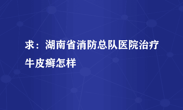 求：湖南省消防总队医院治疗牛皮癣怎样