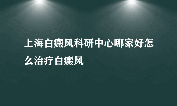 上海白癜风科研中心哪家好怎么治疗白癜风