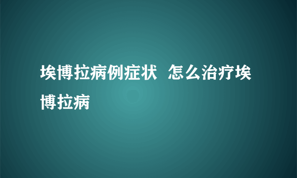 埃博拉病例症状  怎么治疗埃博拉病