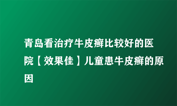 青岛看治疗牛皮癣比较好的医院【效果佳】儿童患牛皮癣的原因