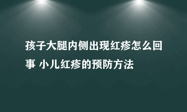 孩子大腿内侧出现红疹怎么回事 小儿红疹的预防方法