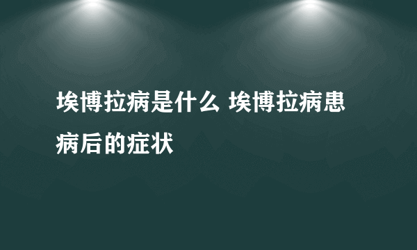 埃博拉病是什么 埃博拉病患病后的症状