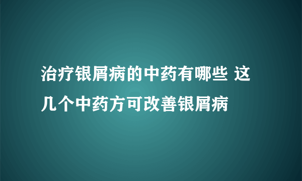 治疗银屑病的中药有哪些 这几个中药方可改善银屑病