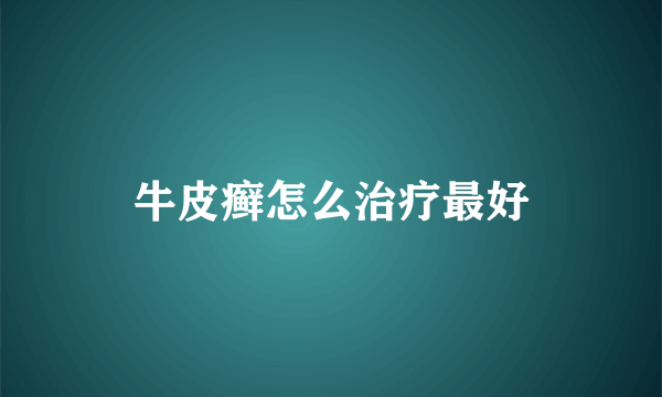 牛皮癣怎么治疗最好