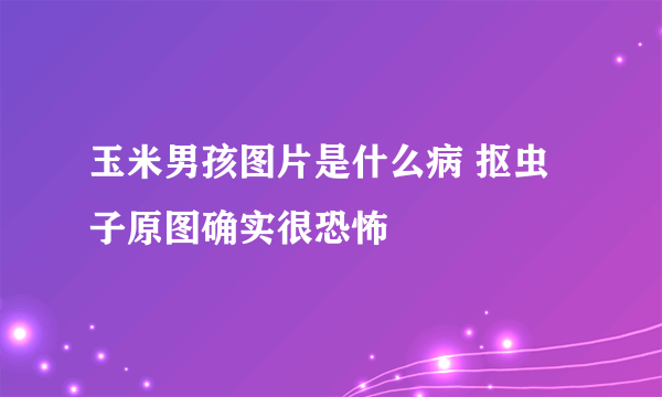 玉米男孩图片是什么病 抠虫子原图确实很恐怖