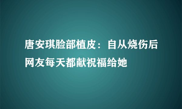 唐安琪脸部植皮：自从烧伤后网友每天都献祝福给她