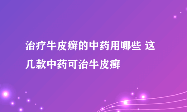 治疗牛皮癣的中药用哪些 这几款中药可治牛皮癣