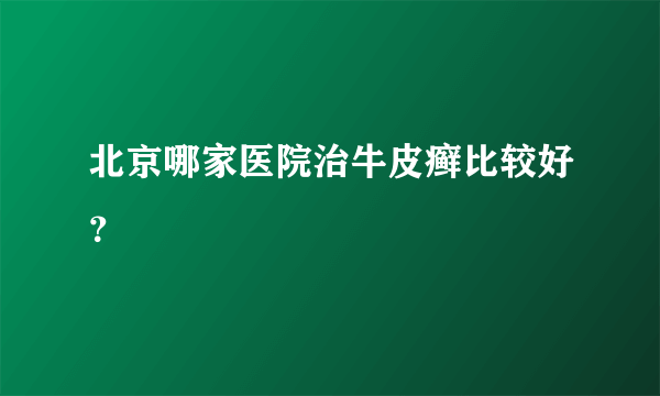 北京哪家医院治牛皮癣比较好？