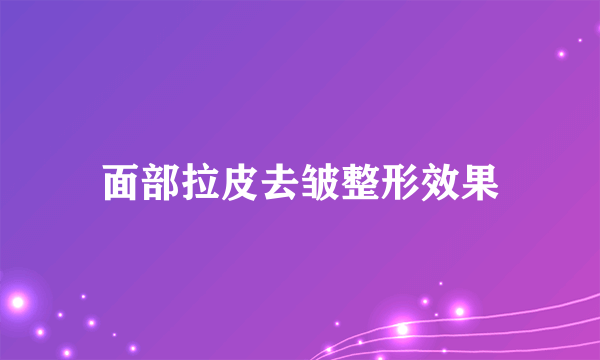 面部拉皮去皱整形效果