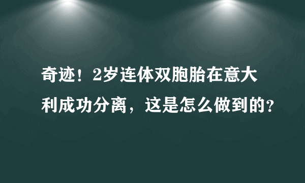 奇迹！2岁连体双胞胎在意大利成功分离，这是怎么做到的？