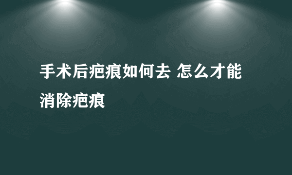 手术后疤痕如何去 怎么才能消除疤痕