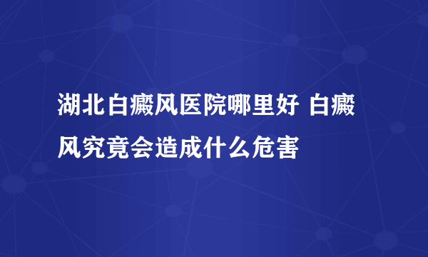 湖北白癜风医院哪里好 白癜风究竟会造成什么危害