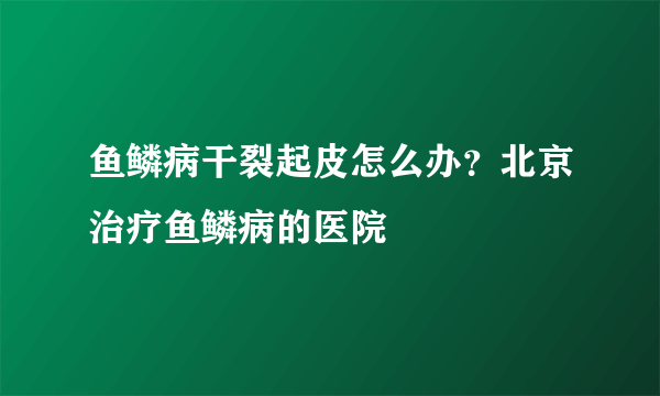 鱼鳞病干裂起皮怎么办？北京治疗鱼鳞病的医院