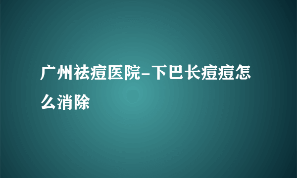 广州祛痘医院-下巴长痘痘怎么消除