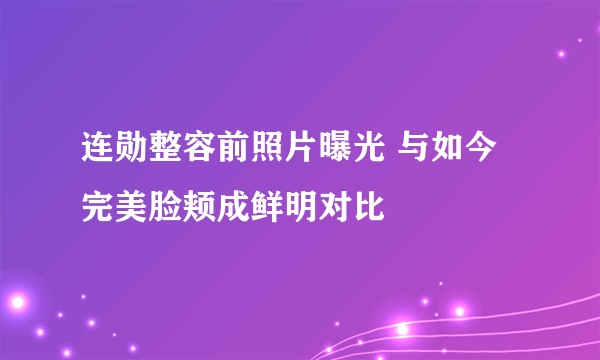 连勋整容前照片曝光 与如今完美脸颊成鲜明对比