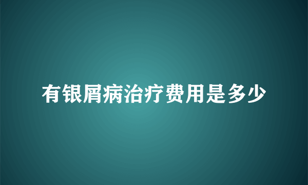 有银屑病治疗费用是多少